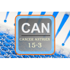 Cancer Antigen ELISA - CA 15-3