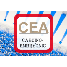 Carcinoembryonic Antigen ELISA - CEA