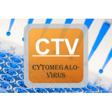 Cytomegalovirus ELISA - CMV IgG