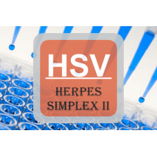 Herpes Simplex Virus ELISA - HSV II IgG