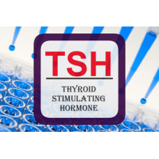 Thyroid Stimulating Hormone ELISA - Ultra-Sensitive TSH (U-TSH)