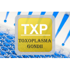 Toxoplasma ELISA - Toxo IgM