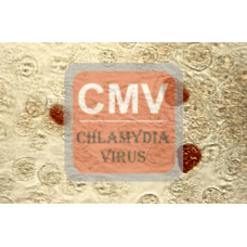 Chlamydia Antibody (pAb) - Rabbit