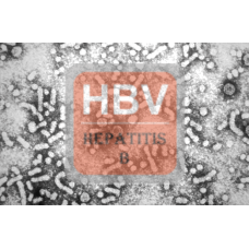 Hepatitus B (whole) Antibody (mAb) - Mouse